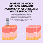 Système de micro-infusion Nymeria™