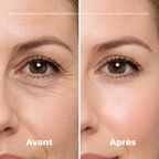 Patchs liftant contour des yeux