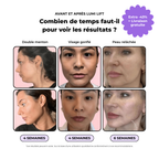 FaceLift