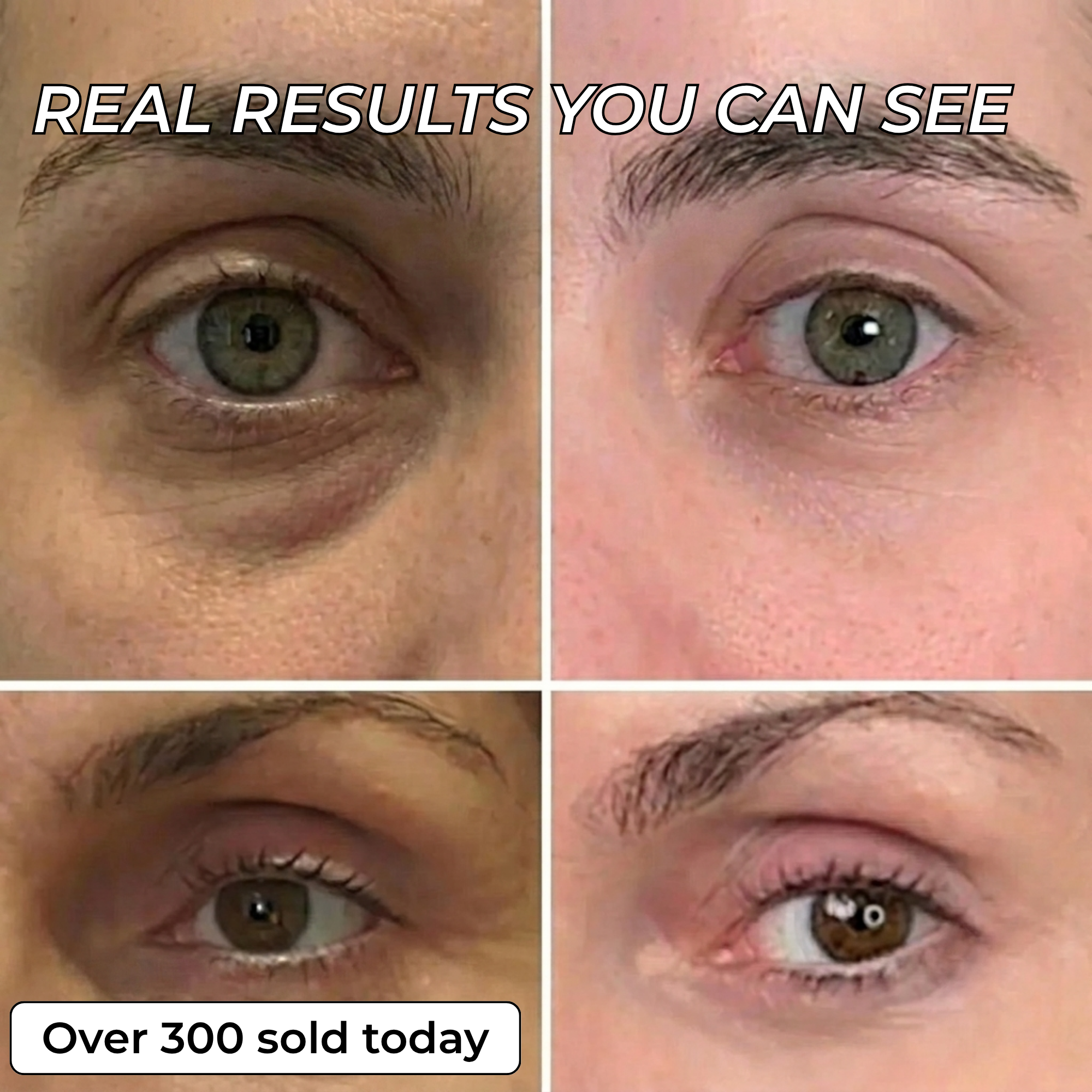 PDRN BIO-COLLAGEN PLUMPING STICK