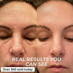 PDRN BIO-COLLAGEN PLUMPING STICK