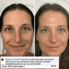 PDRN BIO-COLLAGEN PLUMPING STICK