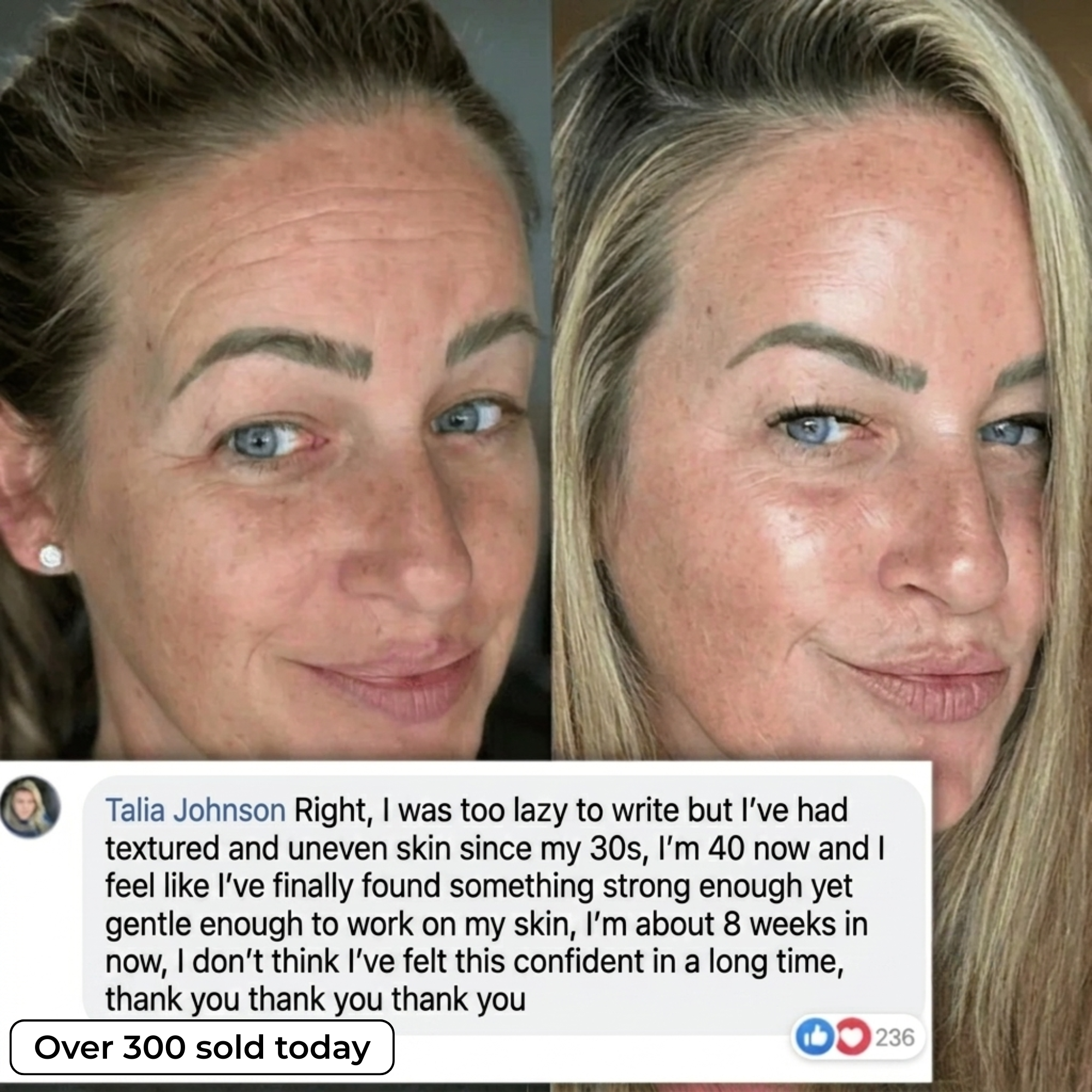 PDRN BIO-COLLAGEN PLUMPING STICK